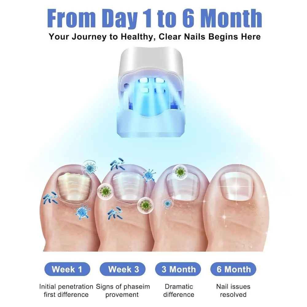 UV Nail Care Device