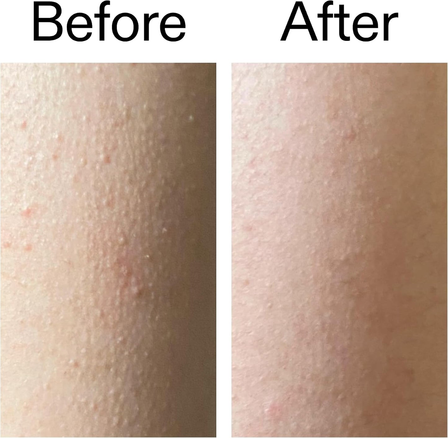 The INKEY List Glycolic Acid Body Stick 45g – 7% Glycolic Acid & Salicylic Acid