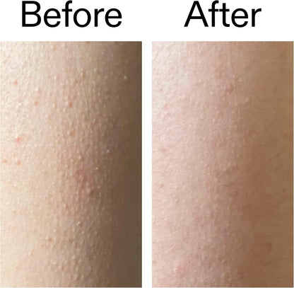 The INKEY List Glycolic Acid Body Stick 45g – 7% Glycolic Acid & Salicylic Acid