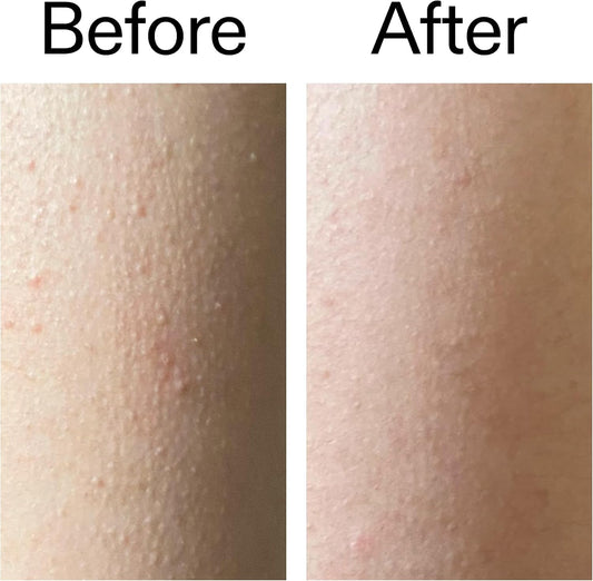 The INKEY List Glycolic Acid Body Stick 45g – 7% Glycolic Acid & Salicylic Acid