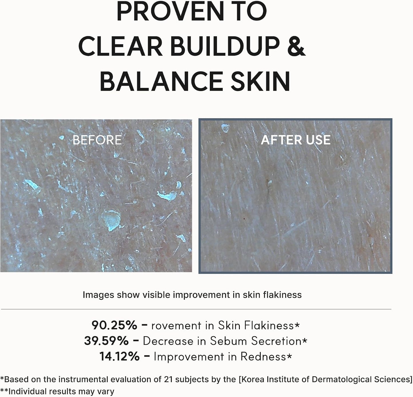 Arencia Eraser Serum 30ml – Glycolic Acid AHA BHA Exfoliating Face Serum