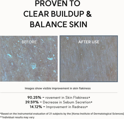 Arencia Eraser Serum 30ml – Glycolic Acid AHA BHA Exfoliating Face Serum